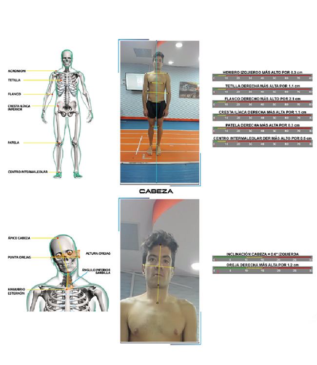 Bikefitting ciclismo