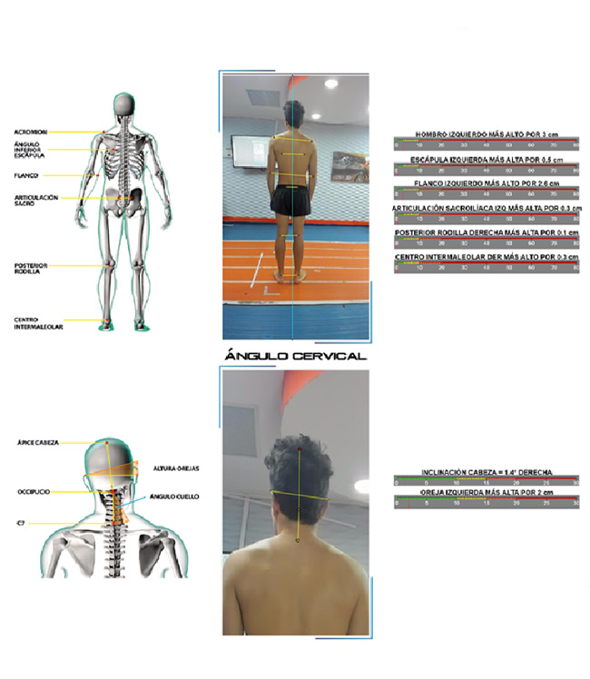 Bikefitting ciclismo