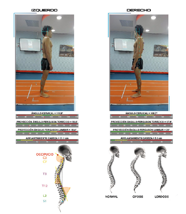 Bikefitting ciclismo