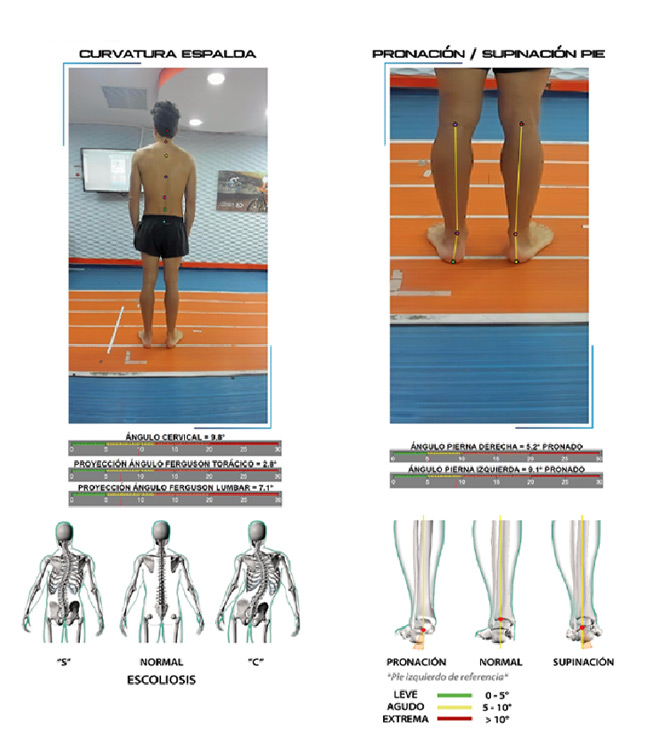 Bikefitting ciclismo