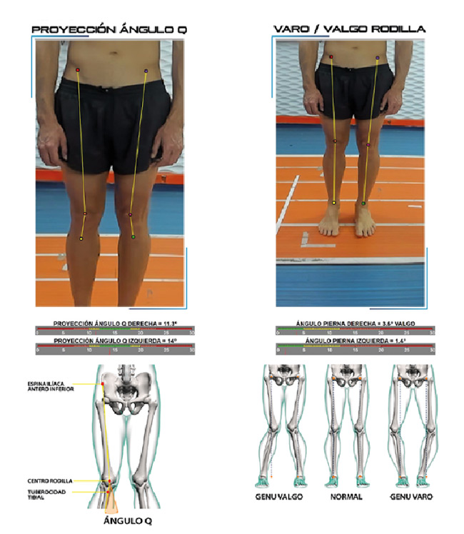 Bikefitting ciclismo
