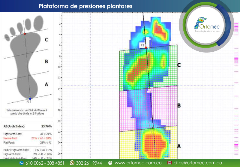plataformas plantares Bogotá